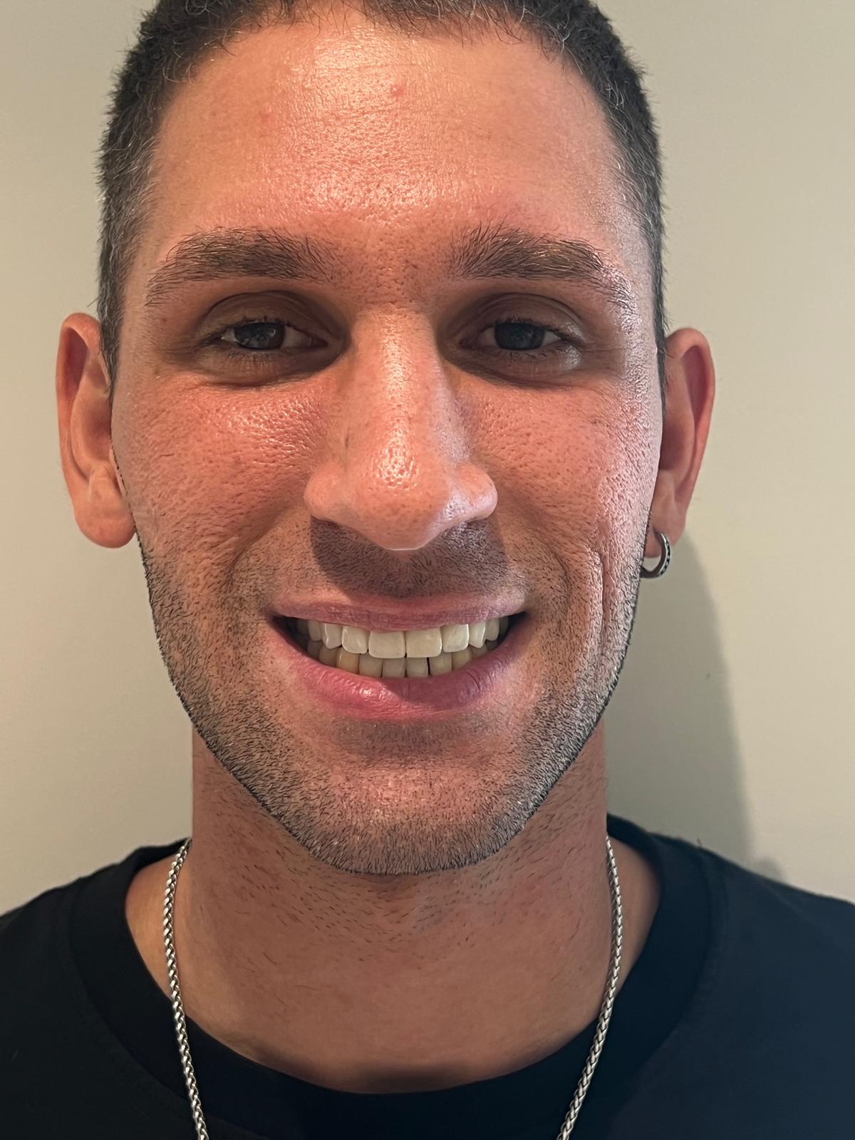 ECE Dental Patient Result